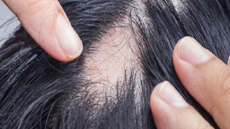 Besin Değeri ve Sindirim Sistemi Üzerindeki Etkileri