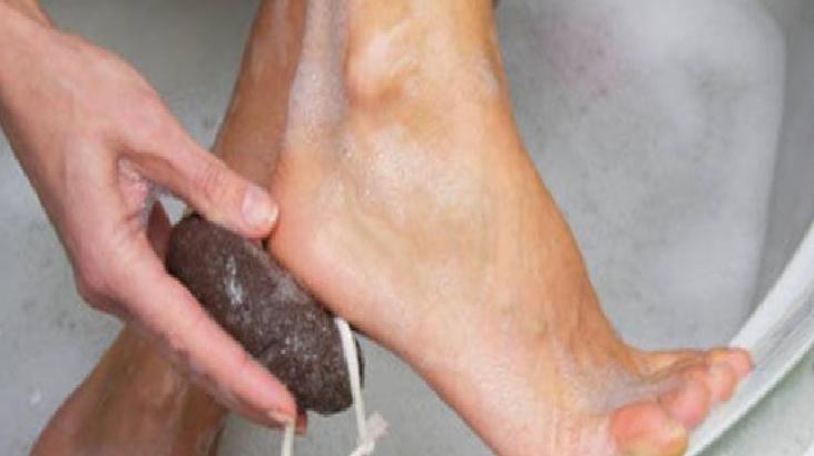 Ayak Mantarı: Nedenleri ve Tedavi Yöntemleri