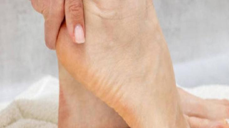 Ayak Mantarı: Nedenleri ve Tedavi Yöntemleri