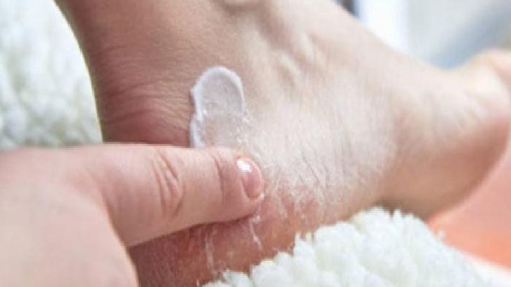 Ayak Mantarı: Nedenleri ve Tedavi Yöntemleri