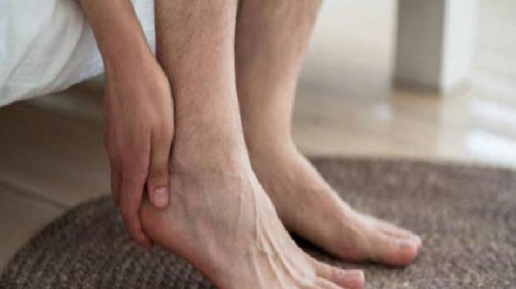 Ayak Mantarı: Nedenleri ve Tedavi Yöntemleri