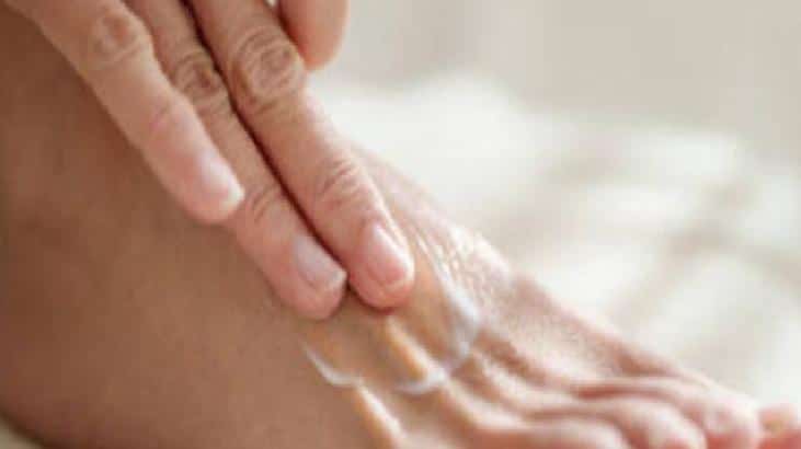 Nasırdan Kurtulmanın Doğal Yöntemleri