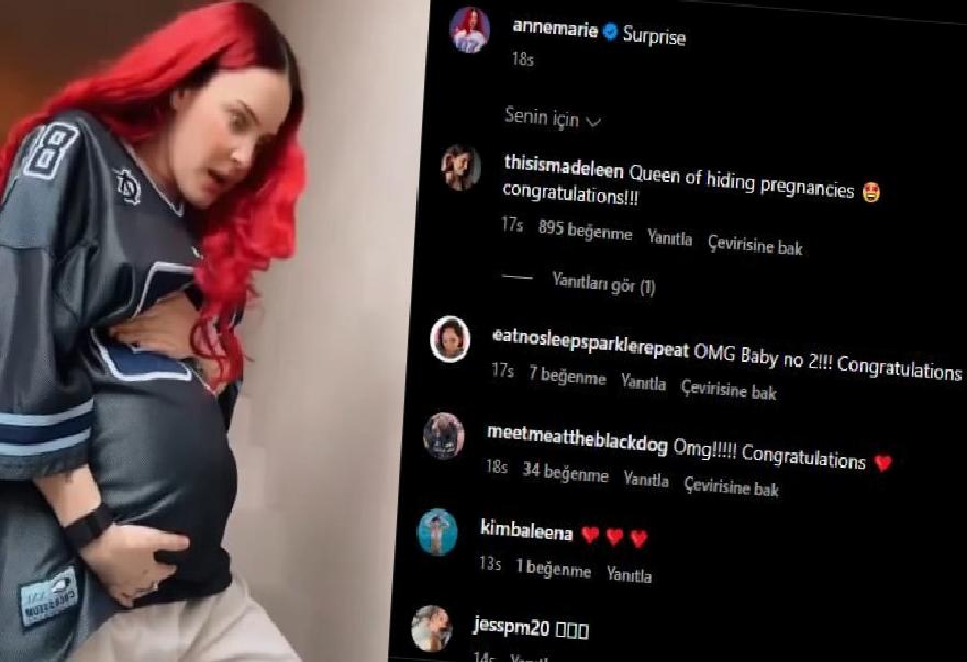 Anne-Marie İkinci Çocuk Müjdesini Verdi