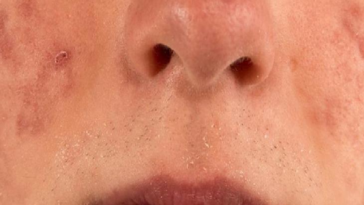 Cevizin Cilde Faydaları ve Doğal Bakım Maskesi Tarifi