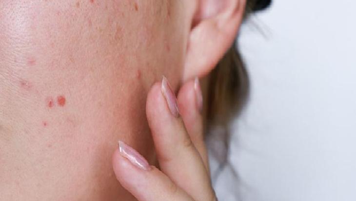 Cevizin Cilde Faydaları ve Doğal Bakım Maskesi Tarifi