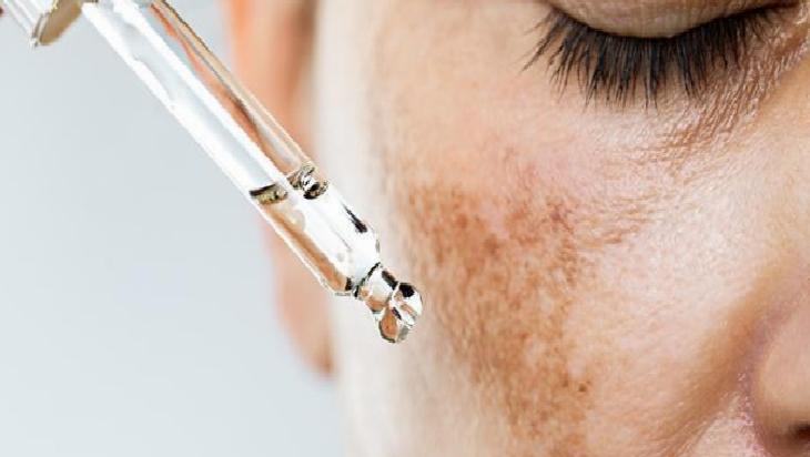 Dikkat Edilmesi Gerekenler