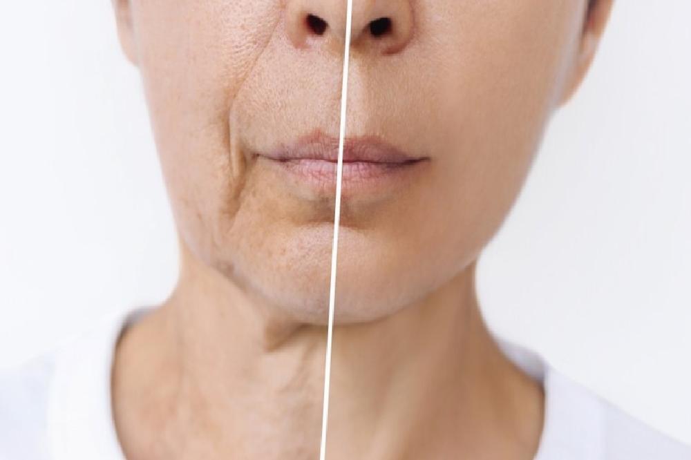 Kırışıklıkları Önlemek İçin Alınacak Önlemler