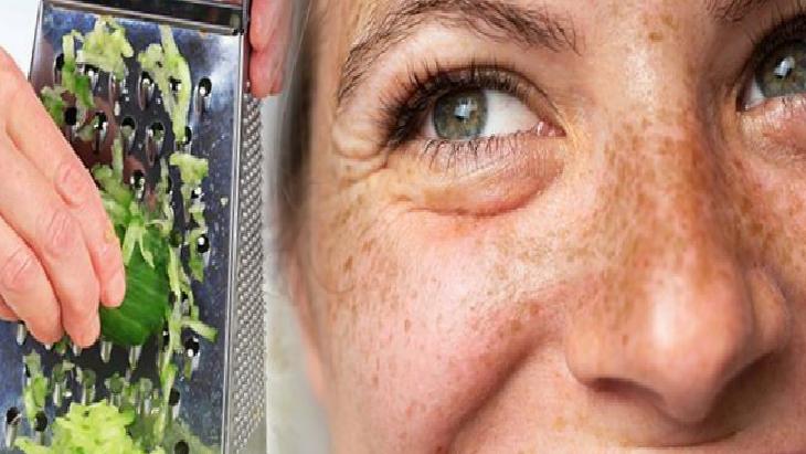 Doğal Yöntemlerle Cilt Lekeleri ile Mücadele