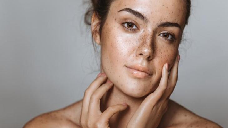 Doğal Yöntemlerle Cilt Lekeleri ile Mücadele