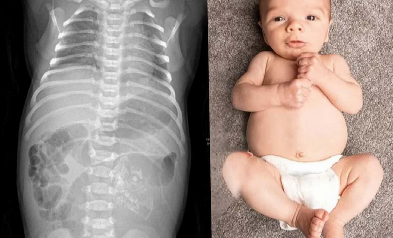 Hindistan'da Eşine Az Rastlanan Doğum Olayı