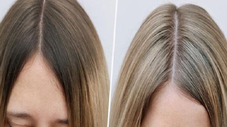 İskandinav Saç Çizgisi: Saç Bakımında Yeni Bir Trend