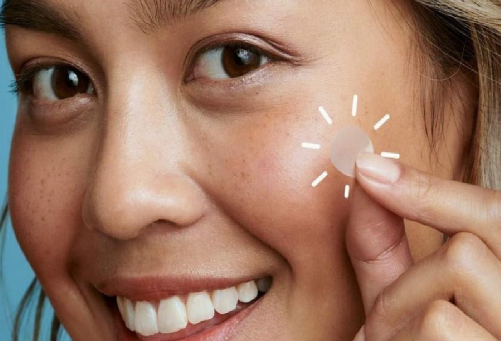 Sivilce Bantları: Mucizevi Çözüm mü, Geçici Rahatlama mı?