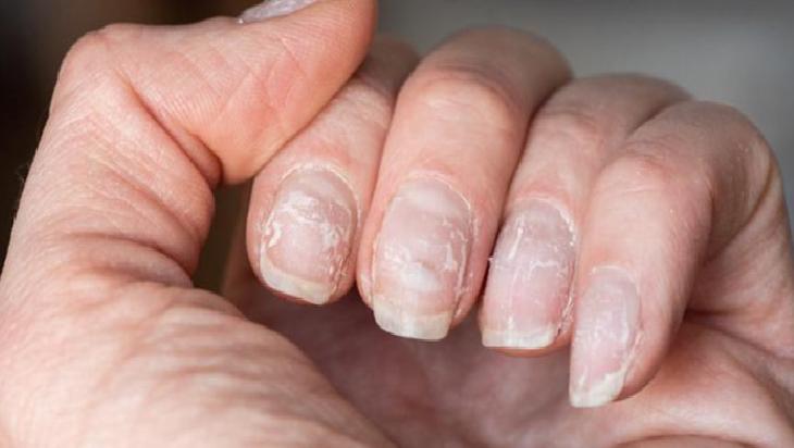Tırnak Bakımında Aseton ve Doğal Yağların Faydaları