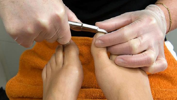 Batık Tırnak Tedavisi için Doğal Yöntemler