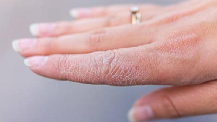 Doğal Şeker Peelingi ile Yumuşak Eller