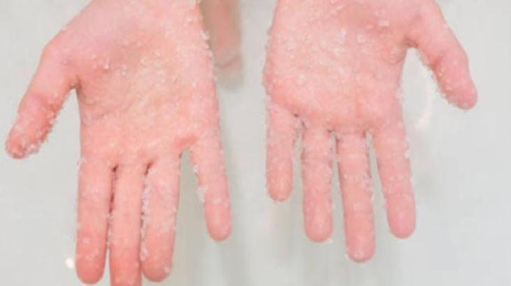 Doğal Şeker Peelingi ile Yumuşak Eller