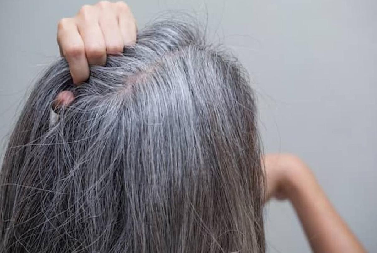 Erken Yaşta Saç Beyazlaması: Nedenleri ve Etkileri