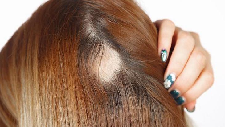 İlik Yağının Saç Sağlığına Faydaları