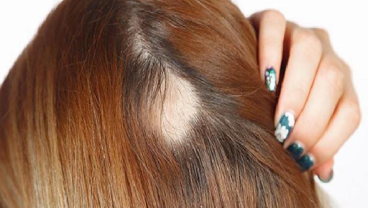 İlik Yağının Saç Sağlığına Faydaları