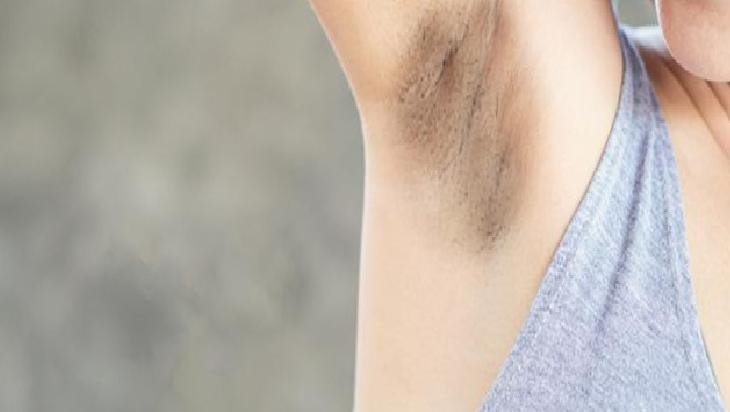 Koltuk Altı Kararmalarını Giderme Yöntemleri