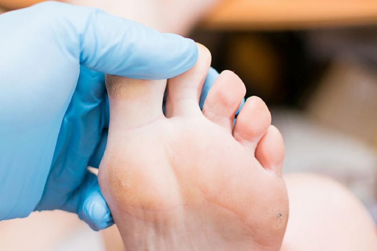 Tıbbi Müdahale Gerekli Mi?