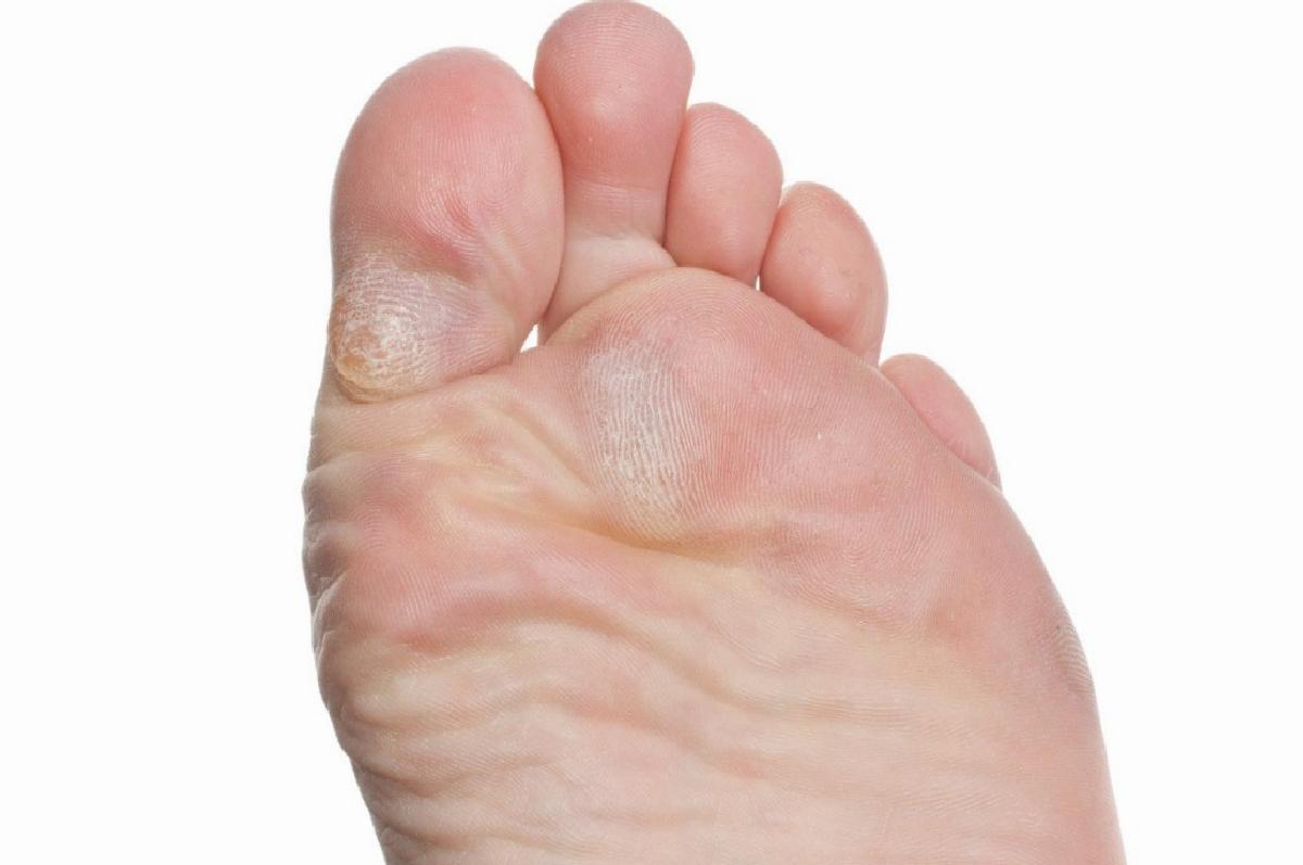 Nasır Nerelerde Görülür?