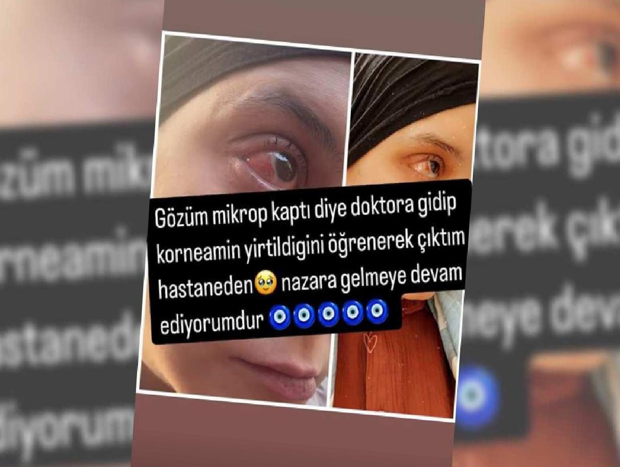 Göz Sağlığıyla İlgili Üzücü Haber