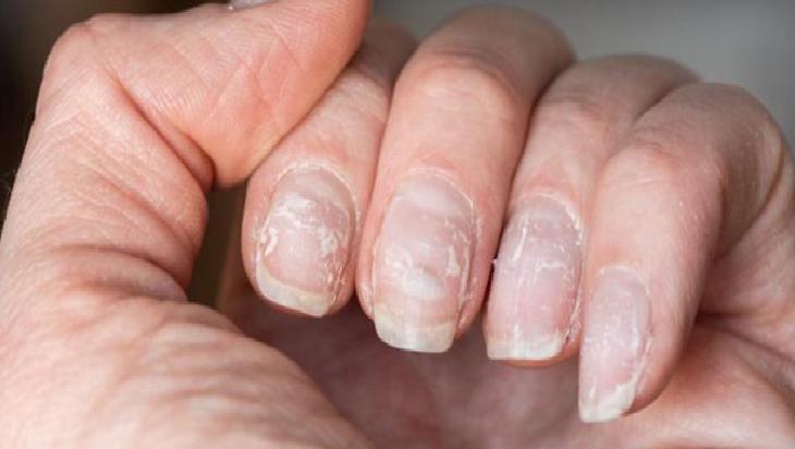 Hindistan Cevizi Yağı ile Gece Bakımı