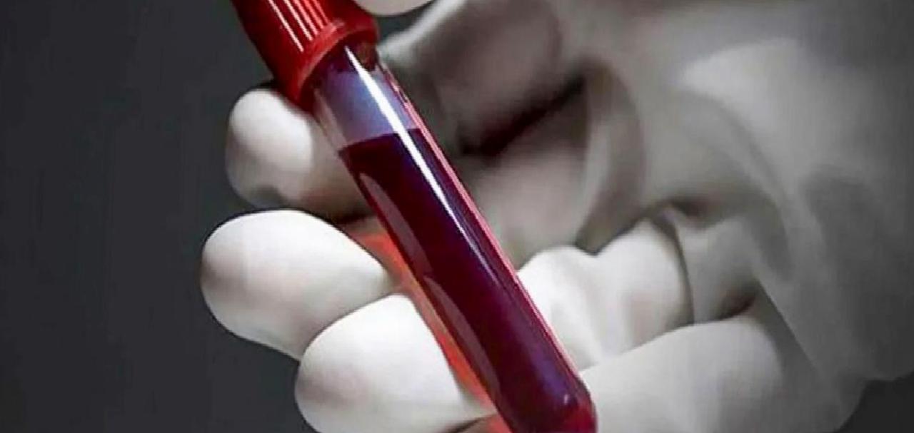 Günümüzde Yorgunluk ve Modern Yaşamın Etkileri