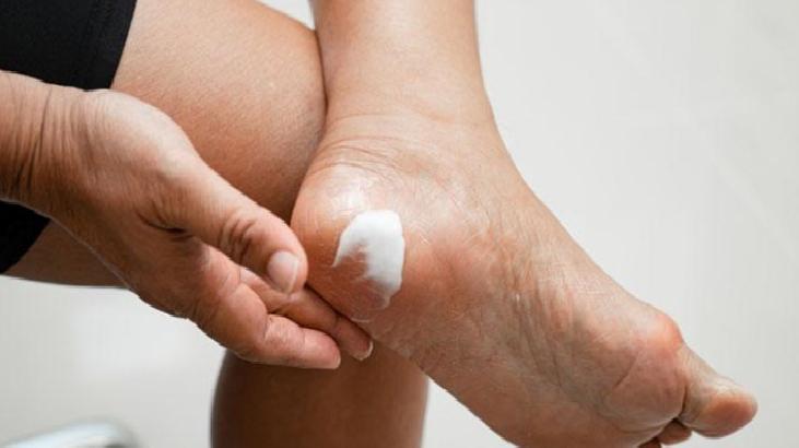Ayak Peeling Ürünlerinin İçeriği ve Kullanım Riskleri