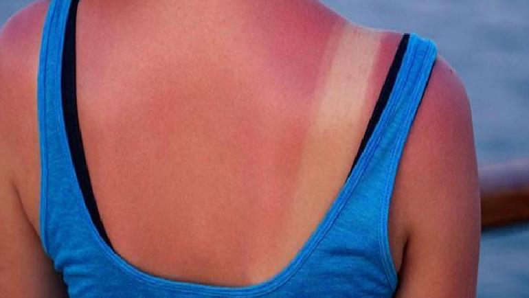 Bronzlaştırıcı Ürünlerin Güneş Koruma Faktörü ve Güvenliği