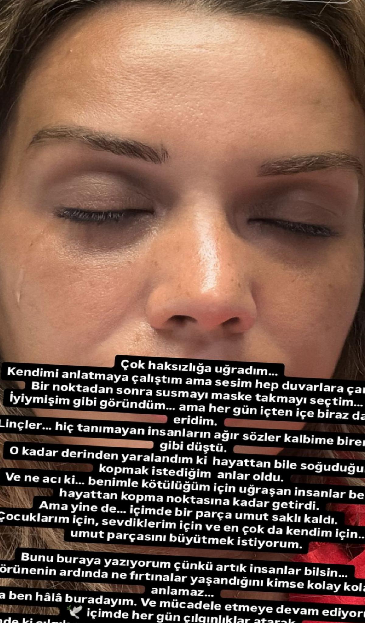 Dilan Polat, Psikolojik Destek Almak İçin Kliniklere Yattığını Açıkladı