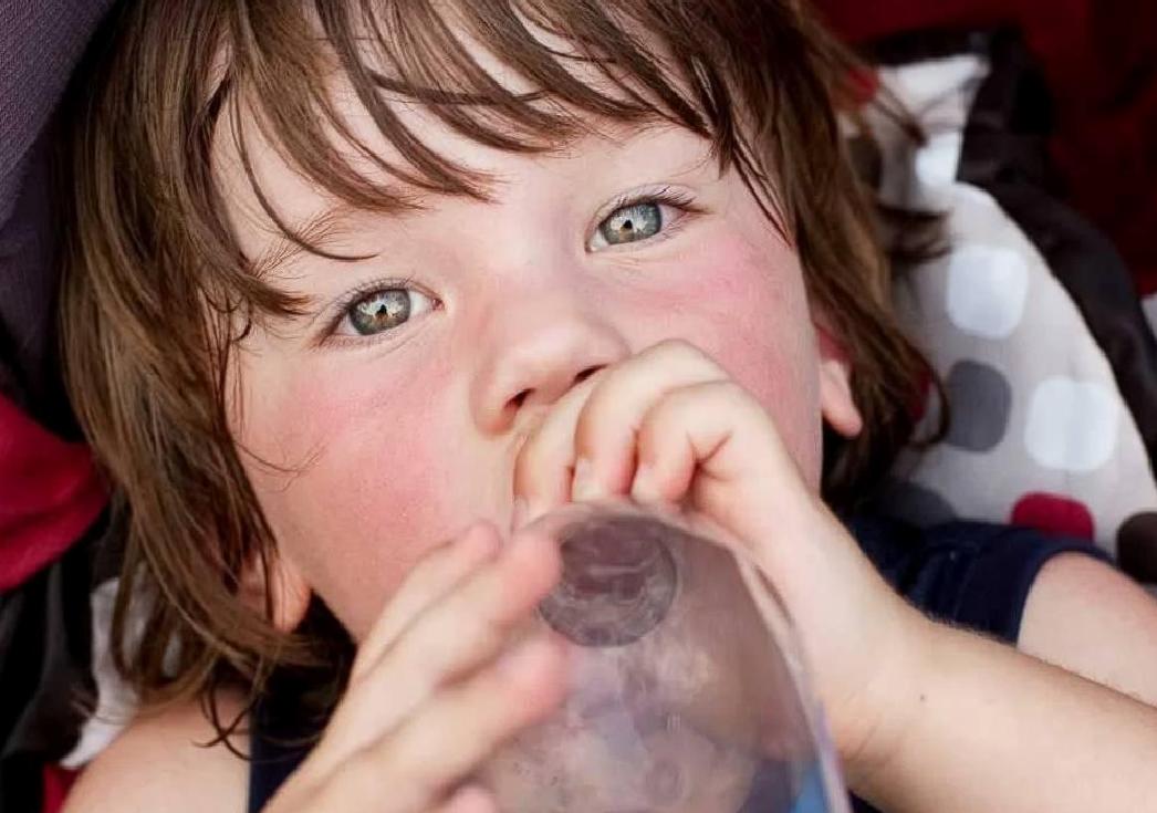 Güneş Çarpması Tedavi Yöntemleri