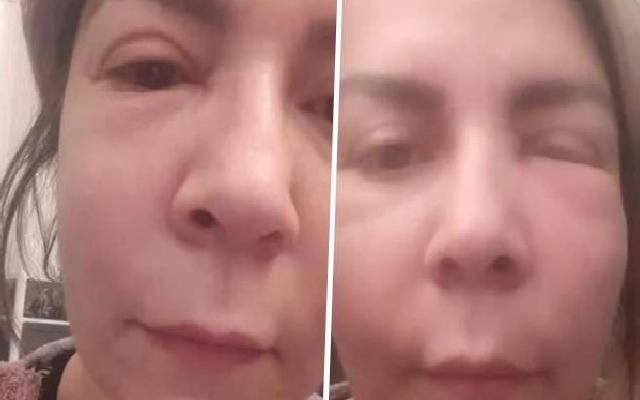 Güzellik Merkezi Seçimi ve İlk Temas