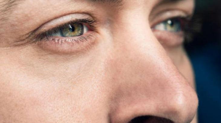 Kirpiklerin Kesilmesinin Göz Sağlığına Olan Zararları