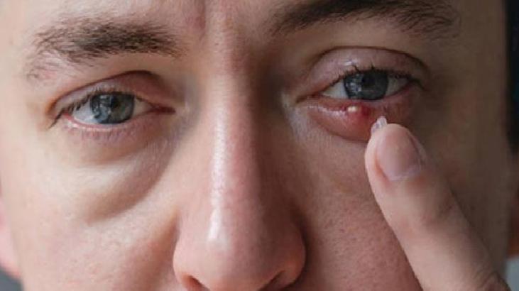 TikTok’ta Viral Olan Kirpik Kesme Akımı ve Göz Sağlığı Üzerine Riskleri