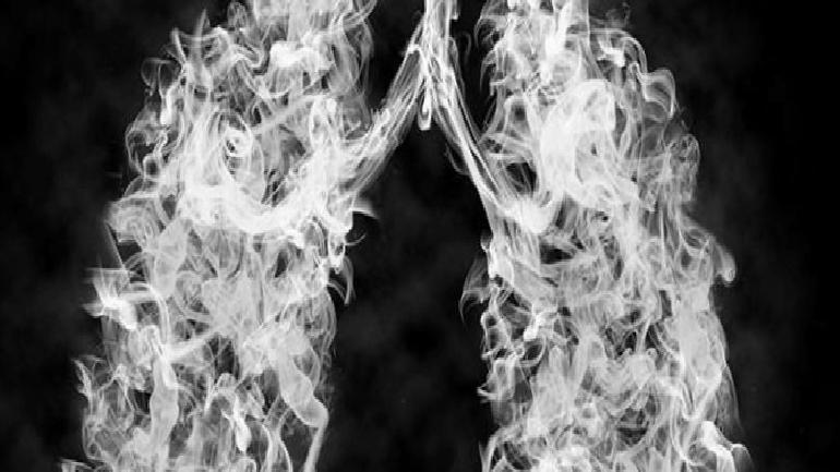 Akciğer Kanseri ve Sigara İlişkisi