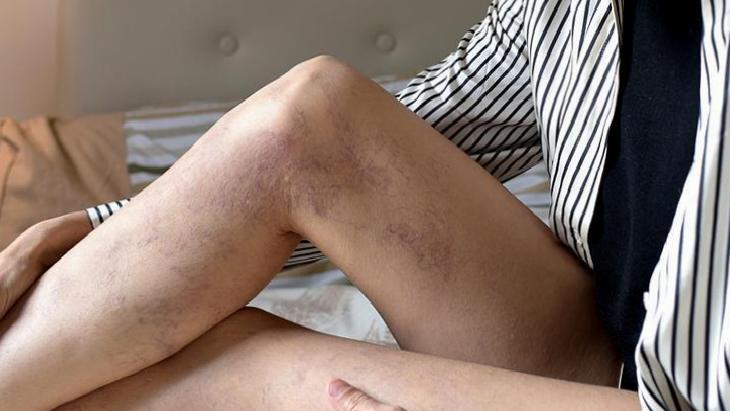 Varis Sorunlarında Kontrol ve Korunma Yöntemleri