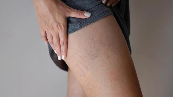 Varis Sorunlarında Kontrol ve Korunma Yöntemleri