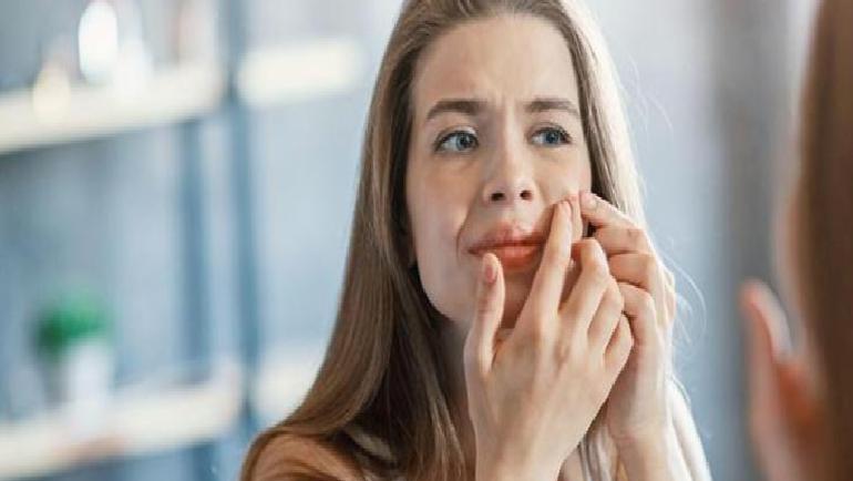 Beyaz Noktaların Oluşumu ve Nedenleri