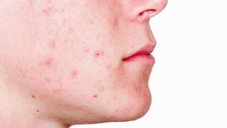 Uzmanlardan Uyarılar ve Bilinçli Kullanım Önerileri