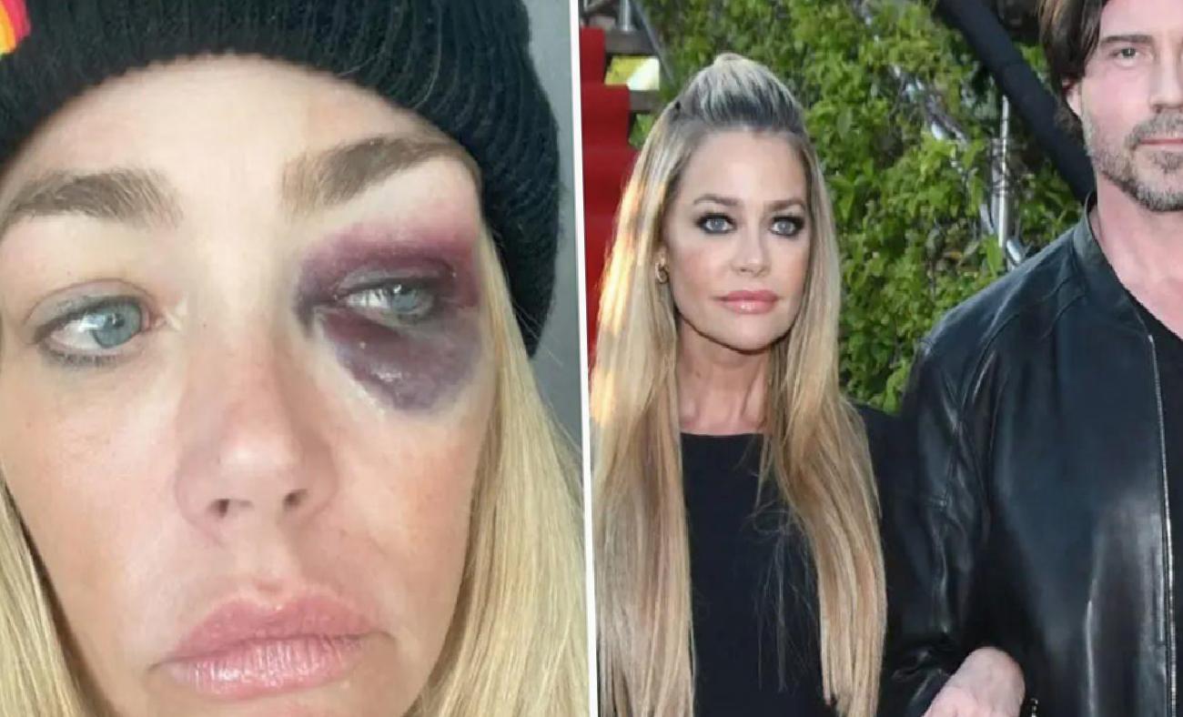 Ünlü Oyuncu ve Eski Model Denise Lee Richards'tan Sözde Kanıtlarla Boşanma İtirafı