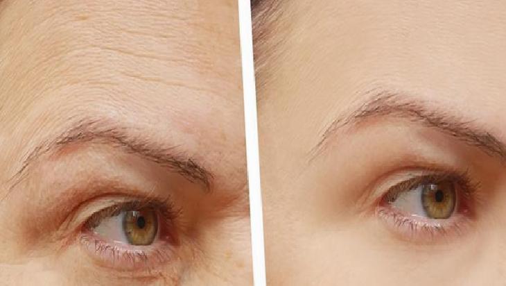 Sosyal Medyada Paylaşılan Ev Yapımı Güneş Kremi Tarifleri