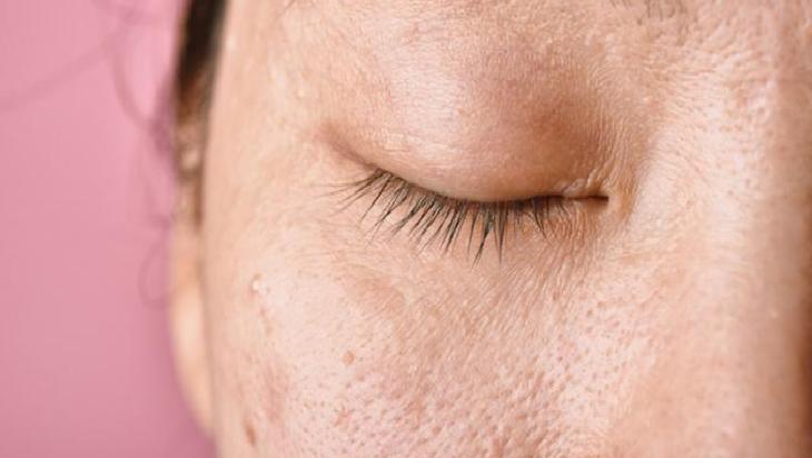 Doğallık ve Güvenlik Arasındaki Denge