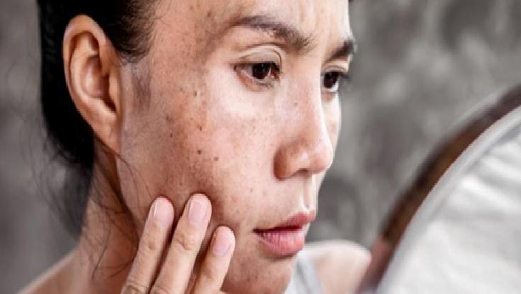 Ev Yapımı Güneş Kremi Tarifleri ve Güvenlik Uyarıları