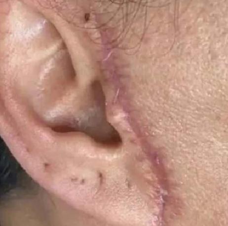 Operasyon Sonrası Korkutucu Durumlar