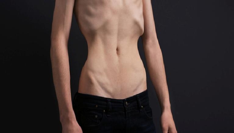 Sosyal Medyanın Görünürlük Baskısı ve Beden İmajına Etkisi