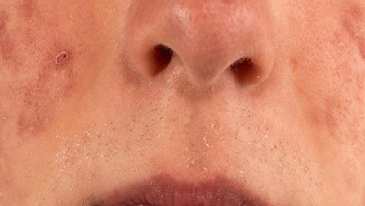 Giysi Seçimi ve Temizliğin Önemi