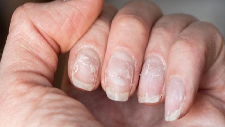 İçten Nemlendirme ve Beslenme