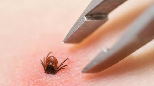 Alfa-Gal Sendromu: Kene Isırıklarıyla Gelen Alerjik Reaksiyonlar Hakkında Bilgilendirici Rehber